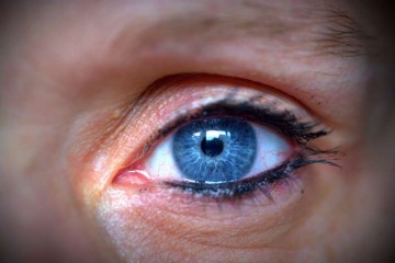 手术怎么去黑眼圈黑眼圈采用的方法是什么